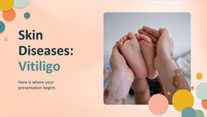 Maladies de la peau : Vitiligo