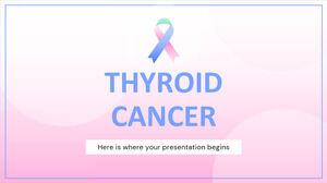 Cancer tiroidian