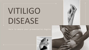 Vitiligo-Krankheit
