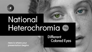 Dia Nacional da Heterocromia: Olhos de Cores Diferentes