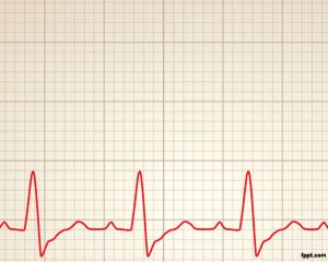 Plantilla de Cardiología del ritmo de Power Point