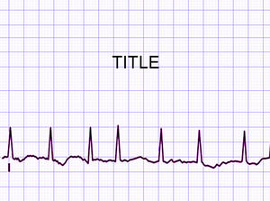 Cardiology ritmo