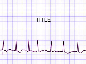 kardiologia Rhythm