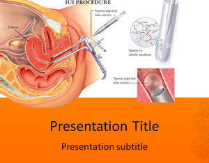 비주얼 수술 의료 PPT 템플릿